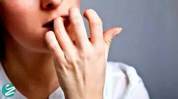 با این ترفند ساده دیگر ناخن‌های خود را نجوید | راهکار عالی 