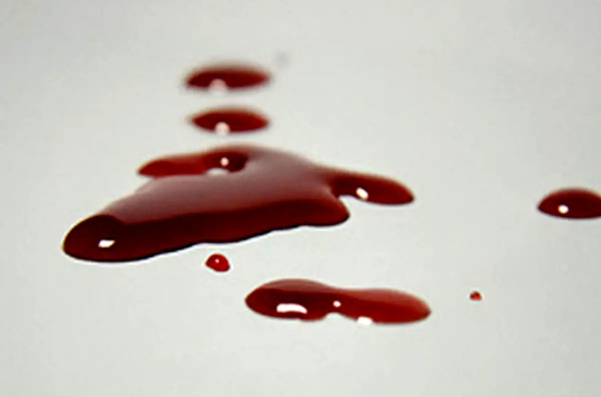 حادثه خونین | قتل مرد جوان در تهران به خاطر یک جاروی دستی پاکبانی!