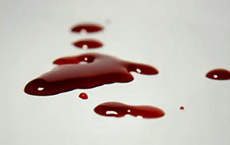 قتل خونین به خاطر سرقت طلا | حادثه خونین در شهر رخ داد