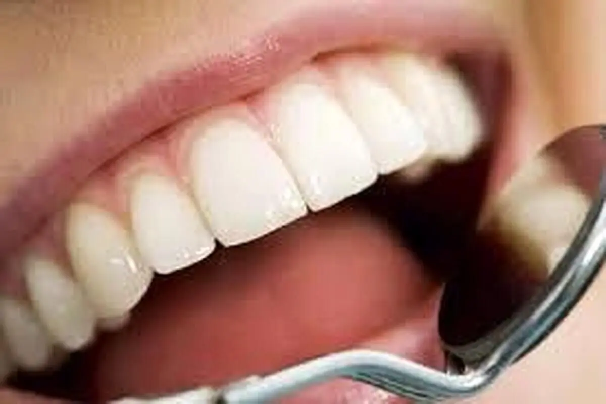 رشد مجدد دندان امکان پذیر شد \ داروی رشد مجدد دندان آماده آزمایش روی انسان شد