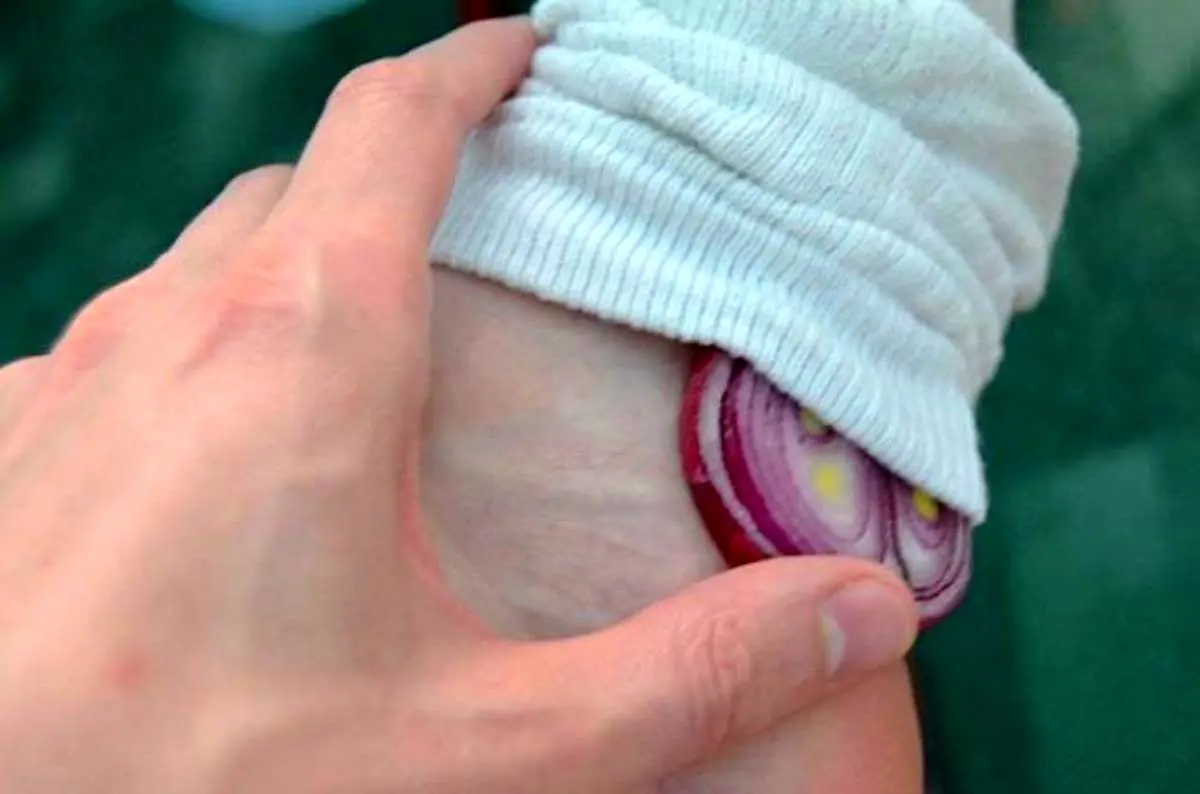 به جای جوراب پیاز پات کن ! | روش درمان خانگی سرماخوردگی با این روش
