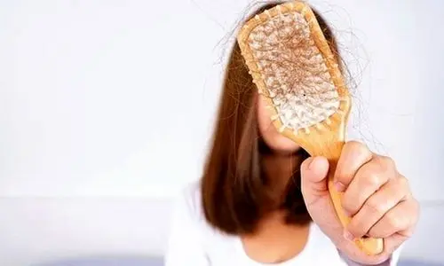 درمان ریزش مو در سه سوت ! | راهکار موثر خانگی برای ریزش مو 