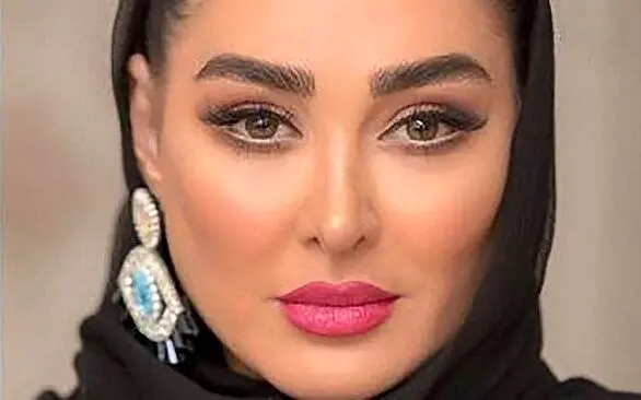 لندن گردی الهام حمیدی و شوهرش با تیپ ست ! | چهره الهام حمیدی با عمل های جدیدش زیر و رو شد + عکس