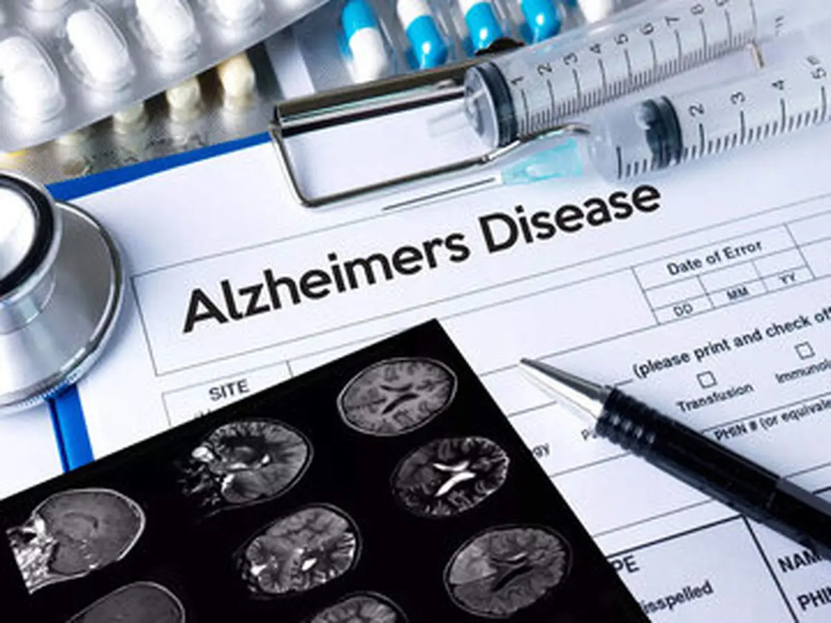 دارو موثر برای بیماری آلزایمر | خبر مهم برای مردم