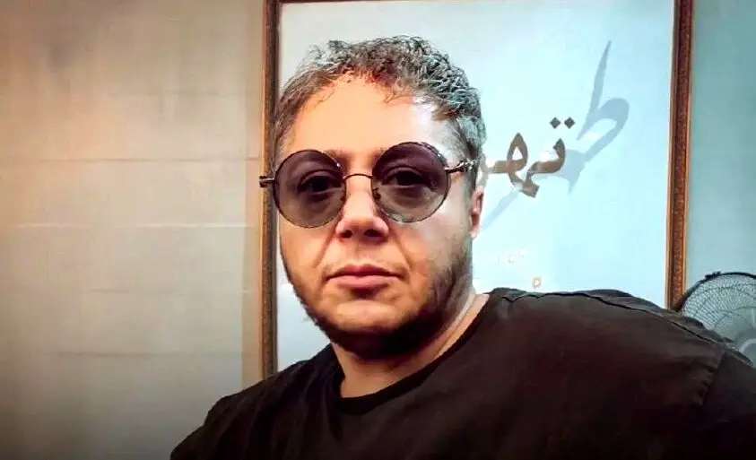 تغییر چهره باورنکردنی مازیار لرستانی بعد از زاویه سازی فک | عمل زیبایی چهره مازیار لرستانی را از این رو به اون رو کرد + ویدئو