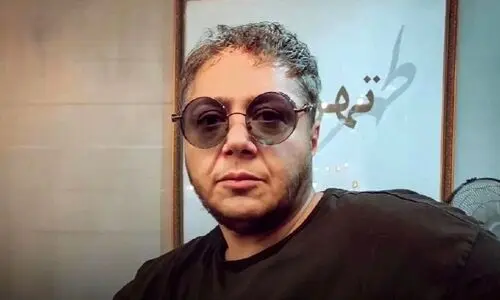تغییر چهره باورنکردنی مازیار لرستانی بعد از زاویه سازی فک | عمل زیبایی چهره مازیار لرستانی را از این رو به اون رو کرد + ویدئو