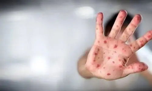 هشدار جدی : شیوع بیماری عفونی خطرناک 