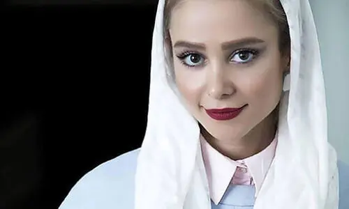 صورت پر از کک و مک الناز حبیبی+عکس