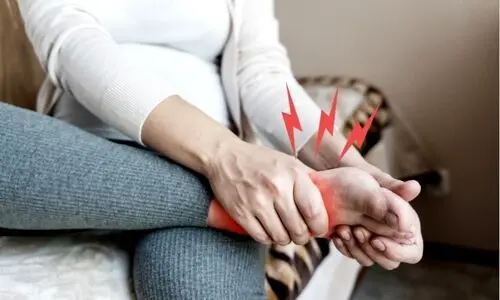 واریس در دوران بارداری: چگونه از بروز آن جلوگیری کنیم؟