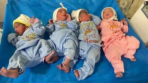 زن زاهدانی که چهار فرزند داشت، چهار قلو به دنیا آورد