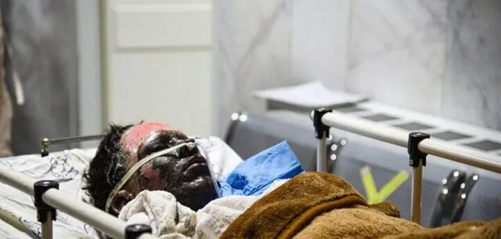 ترکیدن ترقه در دستان پسر 14 ساله | انگشتانش قطع شد