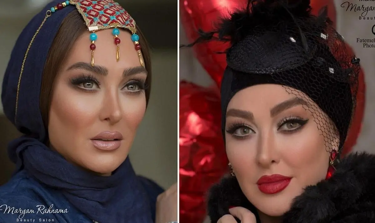 تغییر چهره الهام حمیدی بعد از عمل زیبایی بوکال فت | الهام حمیدی رو ببینی نمیشناسی