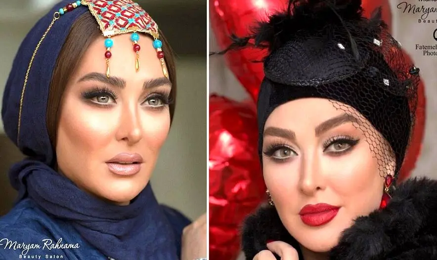 تغییر چهره الهام حمیدی بعد از عمل زیبایی بوکال فت | الهام حمیدی رو ببینی نمیشناسی