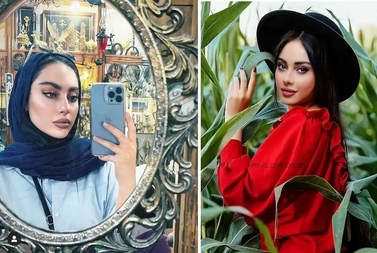 عکس جنجالی ترلان پروانه حسابی سوژه شد | جراحی زیبایی جدید ترلان پروانه زبانزد همه شد