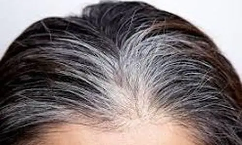 درمان فوری سفیدی موهای سر | برای جلوگیری از سفید شدن مو چی بخوریم؟