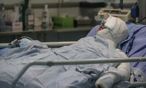 اسیدپاشی وحشتناک مرد شکاک در تهران