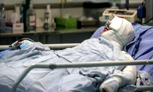 اسیدپاشی وحشتناک مرد شکاک در تهران