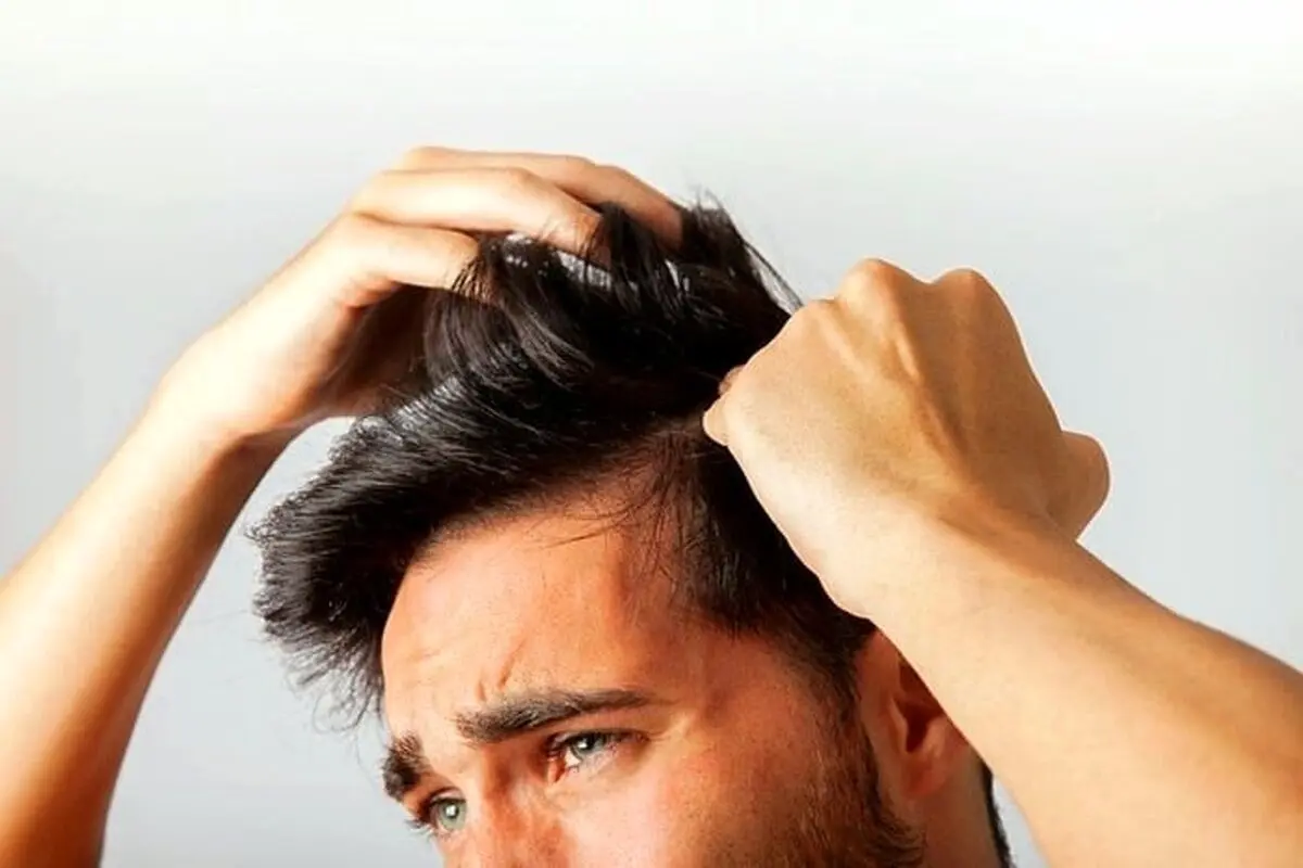 چرا موهایتان درد میکند؟ | بهترین درمان درد ریشه موی سر 