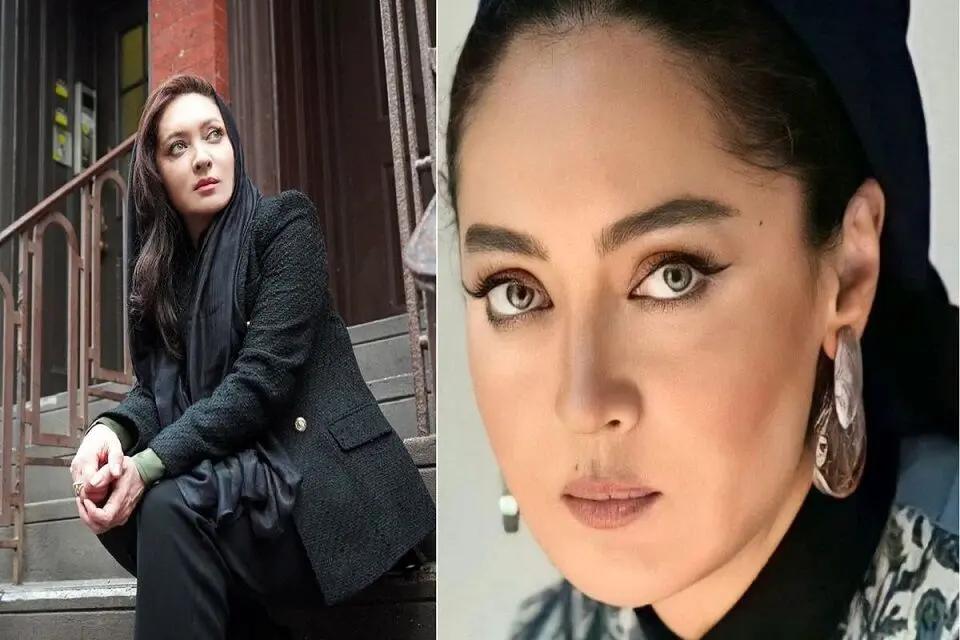 چهره ترسناک و وحشتناک نیکی کریمی بعد از جراحی | نیکی کریمی چه بلایی سر خودش آورد
