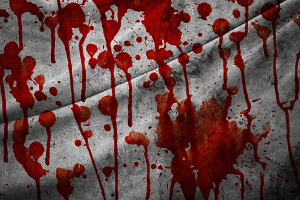 پسر جوان در حال آتش زدن پدرش دستگیر شد | همیشه از طرف پدرم سرکوب و تحقیر می شدم !