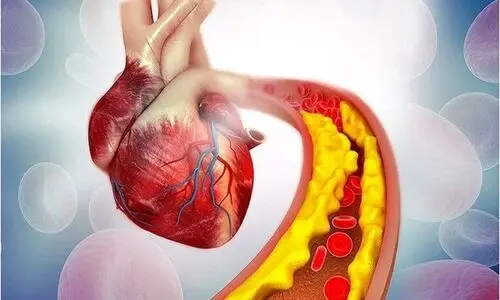 کلسترول خون بالا دارید بخوانید |  برای کاهش کلسترول خون چی بخوریم؟