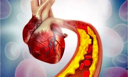 کلسترول خون بالا دارید بخوانید |  برای کاهش کلسترول خون چی بخوریم؟