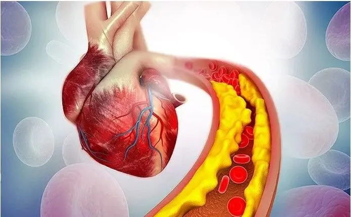 کلسترول خون بالا دارید بخوانید |  برای کاهش کلسترول خون چی بخوریم؟